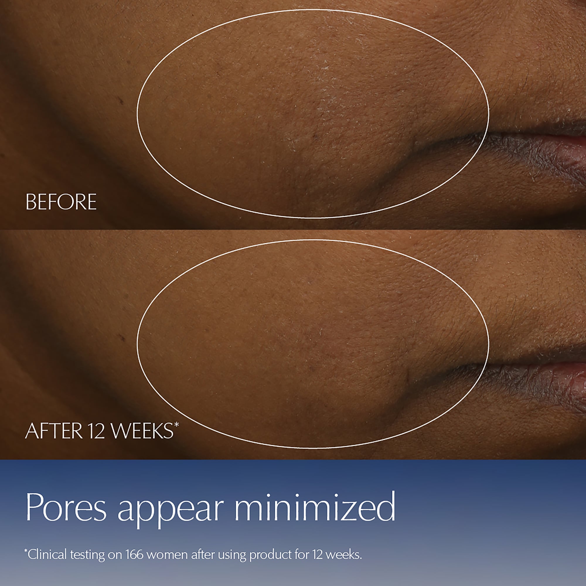 Advanced Night Repair | 25% Off Advanced Night Repair*