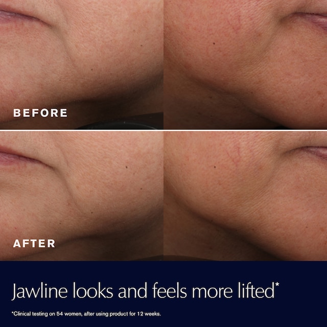 Revitalizing Supreme+ Moisturizer