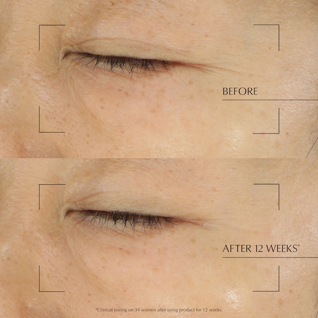 Revitalizing Supreme+