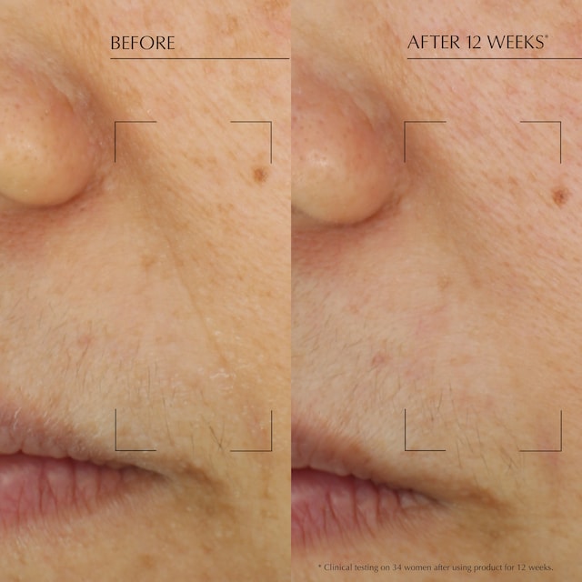 Revitalizing Supreme+