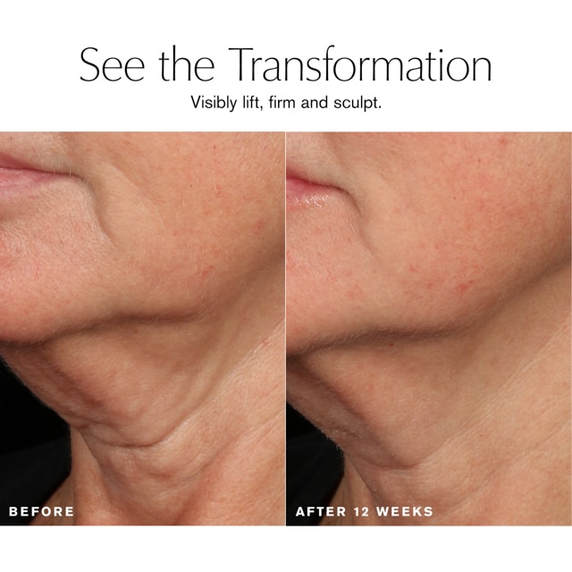 Revitalizing Supreme+